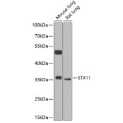 Western blot analysis of extracts of various cell lines using STX11 Antibody (1/1000 dilution).