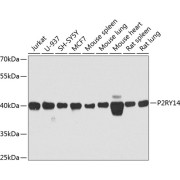 Western blot analysis of extracts of various cell lines using P2RY14 Antibody (1/1000 dilution).