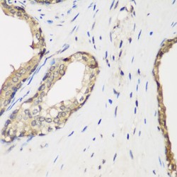 Methyltransferase-Like Protein 7A (METTL7A) Antibody