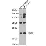 Western blot analysis of extracts of various cell lines using IL36RN Antibody (1/1000 dilution).