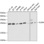 Western blot analysis of extracts of various cell lines using IL36A Antibody (1/1000 dilution).