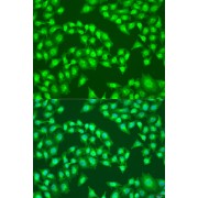 Immunofluorescence analysis of U2OS cells using RSAD2 Antibody (1/100 dilution). Blue: DAPI for nuclear staining.