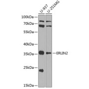 Western blot analysis of extracts of various cell lines using ERLIN2 Antibody (1/1000 dilution).