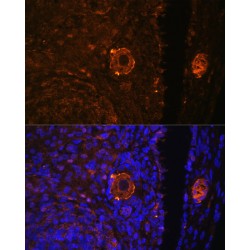 Zona Pellucida Sperm-Binding Protein 3 (ZP3) Antibody