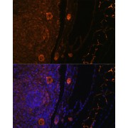 Immunofluorescence analysis of Rat oophoroma cells using ZP3 Antibody (1/100 dilution). Blue: DAPI for nuclear staining.