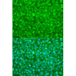 YTH Domain Family Protein 3 (YTHDF3) Antibody