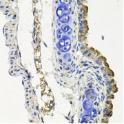 Immunohistochemistry of paraffin-embedded Mouse lung using MARK1 Antibody (1/100 dilution, 40x lens).