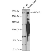 Western blot analysis of extracts of various cell lines using MYO10 Antibody (1/1000 dilution).