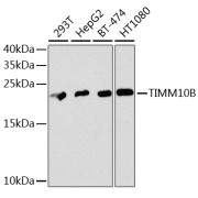 Western blot analysis of extracts of various cell lines using TIMM10B Antibody (1/1000 dilution).