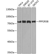 Western blot analysis of extracts of various cell lines using PPP2R3B Antibody (1/1000 dilution).