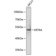 Western blot analysis of extracts of MCF-7 cells using KRT6A Antibody (1/1000 dilution).