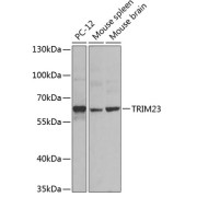 Western blot analysis of extracts of various cell lines using TRIM23 Antibody (1/1000 dilution).