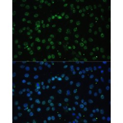 DExD-Box Helicase 39B (DDX39B) Antibody