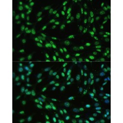 DExD-Box Helicase 39B (DDX39B) Antibody