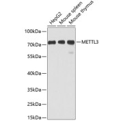 Western blot analysis of extracts of various cell lines using METTL3 Antibody (1/1000 dilution).