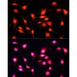 N6-Adenosine-Methyltransferase Catalytic Subunit (METTL3) Antibody