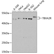 Western blot analysis of extracts of various cell lines using TBXA2R Antibody (1/1000 dilution).