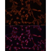 Immunofluorescence analysis of NIH-3T3 cells using ABCB11 Antibody (1/100 dilution, 40x lens). Blue: DAPI for nuclear staining.