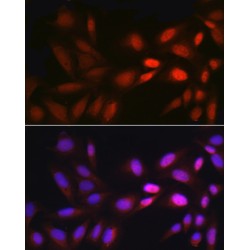 Early Growth Response 1 (EGR1) Antibody