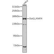 Western blot analysis of extracts of HeLa cells using Dot1L/KMT4 Antibody (1/1000 dilution).