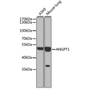 Western blot analysis of extracts of various cell lines using ANGPT1 Antibody (1/1000 dilution).