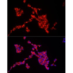 Insulin Receptor Substrate 2 (IRS2) Antibody