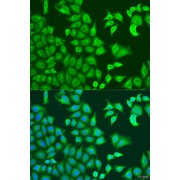 Immunofluorescence analysis of U2OS cells using CAPZB Antibody (1/100 dilution). Blue: DAPI for nuclear staining.