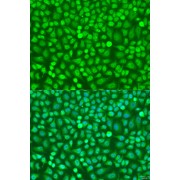 Immunofluorescence analysis of U2OS cells using HOXB5 Antibody (1/100 dilution). Blue: DAPI for nuclear staining.