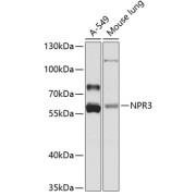 Western blot analysis of extracts of various cell lines using NPR3 Antibody (1/1000 dilution).