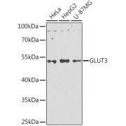 Western blot analysis of extracts of various cell lines using GLUT3 Antibody (1/1000 dilution).