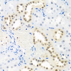 THO Complex 1 (THOC1) Antibody