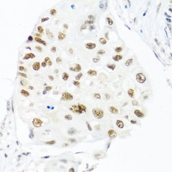 THO Complex 1 (THOC1) Antibody