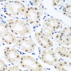 THO Complex 1 (THOC1) Antibody