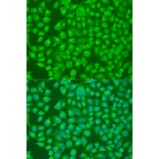 Immunofluorescence analysis of U2OS cells using SLC12A6 Antibody (1/100 dilution). Blue: DAPI for nuclear staining.