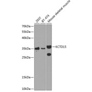 Western blot analysis of extracts of various cell lines using KCTD15 Antibody (1/1000 dilution).