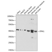 Western blot analysis of extracts of various cell lines using ITPK1 Antibody (1/1000 dilution).