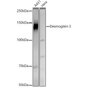 Western blot analysis of extracts of various cell lines using Desmoglein 3 Antibody (1/500 dilution).