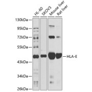 Western blot analysis of extracts of various cell lines using HLA-E Antibody (1/1000 dilution).