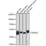 Western blot analysis of extracts of various cell lines using TADA2A Antibody (1/1000 dilution).