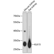 Western blot analysis of extracts of various cell lines using KLK15 Antibody (1/3000 dilution).