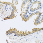 Immunohistochemistry of paraffin-embedded Human prostate using ARL6 Antibody (1/100 dilution, 40x lens).