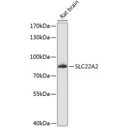 Western blot analysis of extracts of Rat brain using SLC22A2 Antibody (1/1000 dilution).