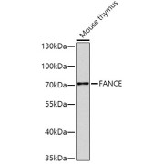 Western blot analysis of extracts of Mouse thymus using FANCE Antibody (1/1000 dilution).