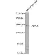 Western blot analysis of extracts of mouse pancreas using ABCC8 Antibody (1/1000 dilution).