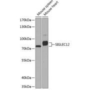 Western blot analysis of extracts of various cell lines using SIGLEC12 Antibody (1/1000 dilution).