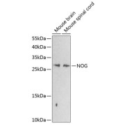 Western blot analysis of extracts of various cell lines using NOG Antibody (1/1000 dilution).