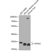 Western blot analysis of extracts of various cell lines using SHOX2 Antibody (1/1000 dilution).