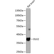 Western blot analysis of extracts of Rat brain using DLX2 Antibody (1/1000 dilution).