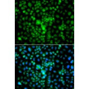 Immunofluorescence analysis of A549 cells using CIDEA Antibody