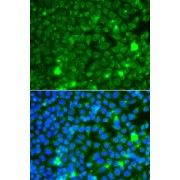 Immunofluorescence analysis of A549 cells using GBA3 Antibody